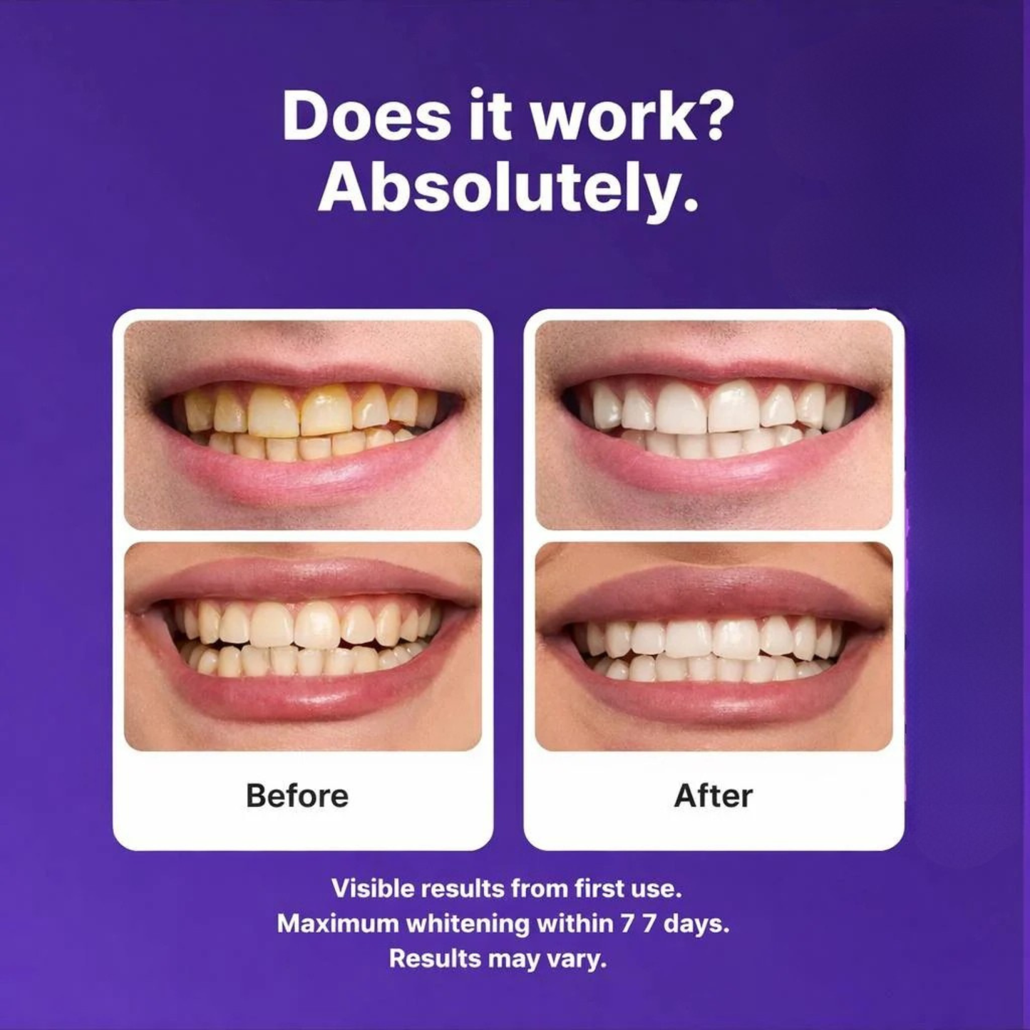 Flufeez Purple Teeth Whitening Strips™