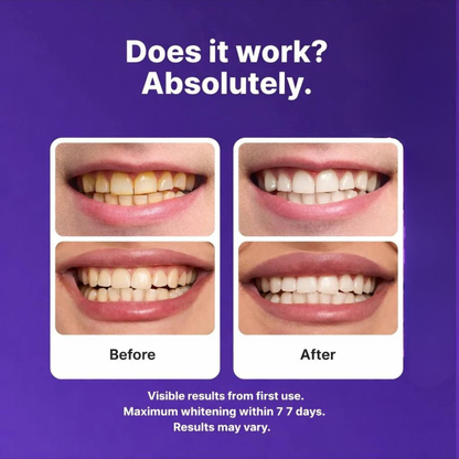 Flufeez Purple Teeth Whitening Strips™